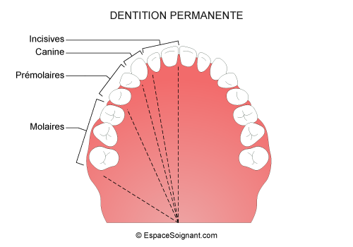 Denture permanente