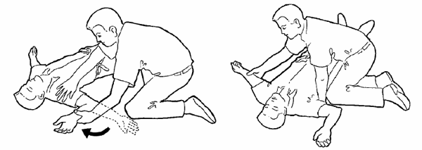 Position latérale de sécurité (PLS)